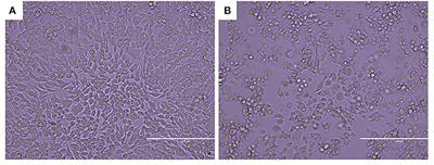 Isolation and Identification of a Murine Norovirus Persistent Infection Strain in China